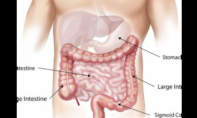 abdomen, intestine, large